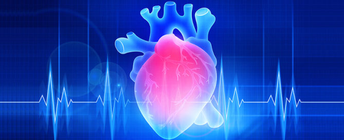 Infinx - Blog - Can AR be Streamlined for Cardiology 8 Tips to Optimize the RCM Process